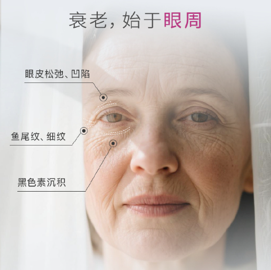 眼周抗衰新视角：来自北京好年华的专业见解