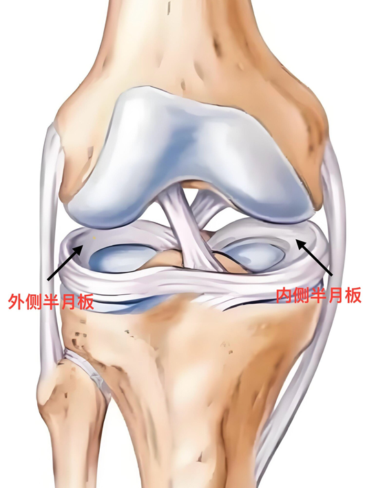 半月板损伤是怎么回事？需要怎么办？骨科专家来告诉你