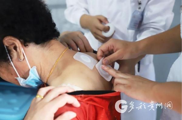 遵义市中医院三伏贴开启 助市民健康度夏，7月20日下一贴别错过