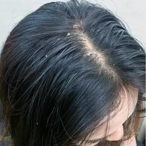 舒蕾第九代绿茶籽洗发露：72h控油+48h蓬松，拯救夏日油痒塌