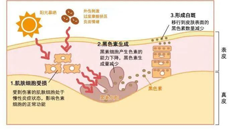 秋季巩固治疗必不可少！北京白癜风专家济南会诊倒计时