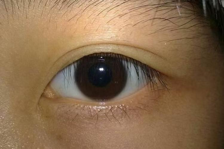 无惧时光守护银龄，十一月启冬护视界！南昌普瑞白内障防治指南：让「飞白」为清晰护航