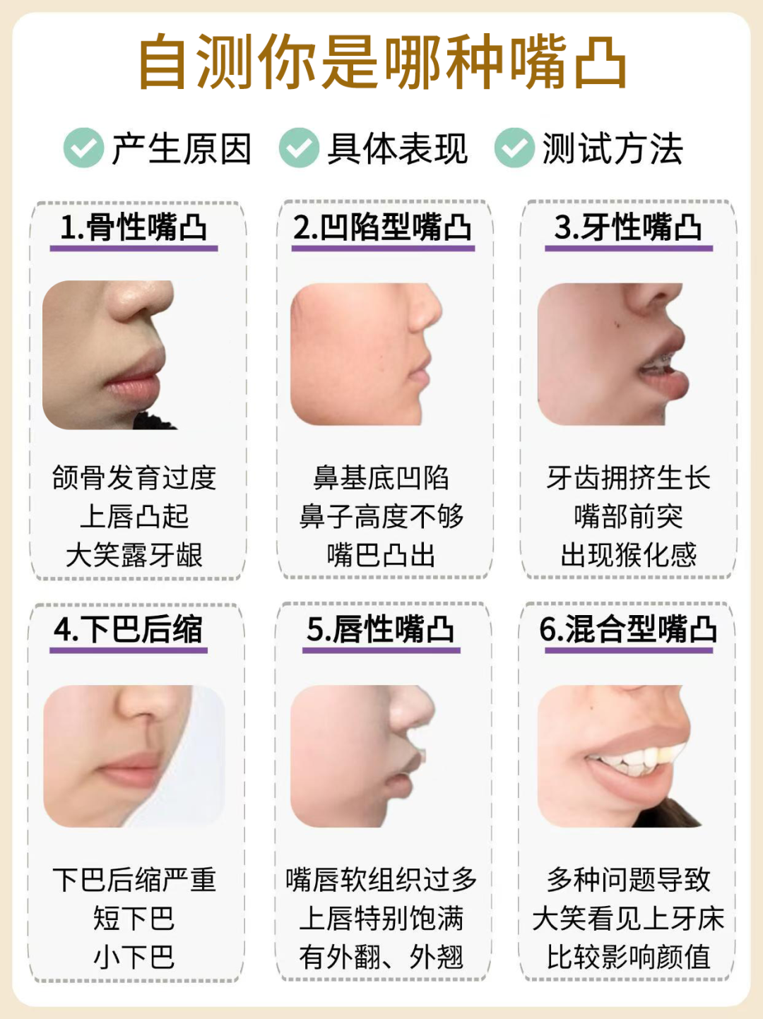 杏林整形医院：6种嘴凸表现，你是哪一种？怎样摆脱土气感？