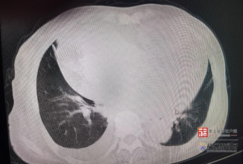老人不明原因乏力、食欲下降？专家提醒：这可能是无声警报